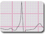 Healio EKG